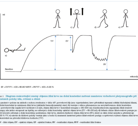 Obr. 1 Diagram znázorňující změny objemu žilní krve na dolní končetině