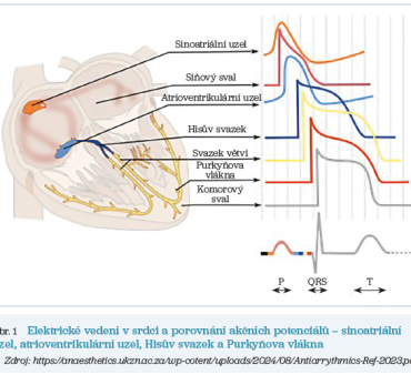 Obr. 1 Elektrické vedení v&nbsp;srdci
