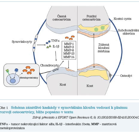 Obr. 1 Schéma zánětlivé kaskády v synoviálním kloubu