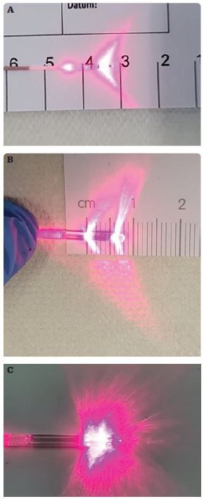 Obr. 1 Vlákno pro endovaskulární laserovou termoablaci s radiální distribucí paprsku: A. v jednom prstenci, B. ve dvou prstencích, C. v radiálním 5mm segmentu.