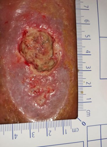 obr 1a 19. den obr 1a 19. den