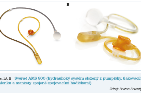 Obr. 1A, B Svěrač AMS 800 Obr. 1A, B Svěrač AMS 800