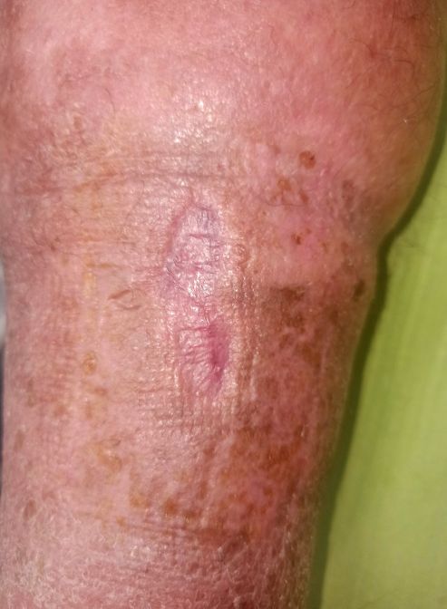 obr 1c 118. den obr 1c 118. den