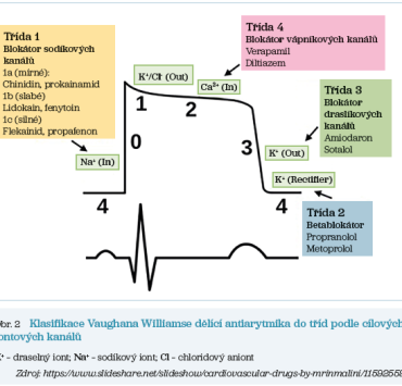 Obr. 2 Klasifikace Vaughana Williamse dělící antiarytmika do&nbsp;tříd