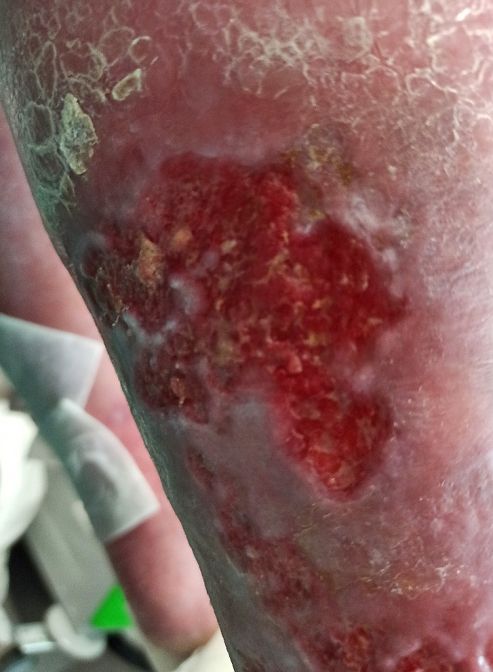 obr 2b 1. den obr 2b 1. den