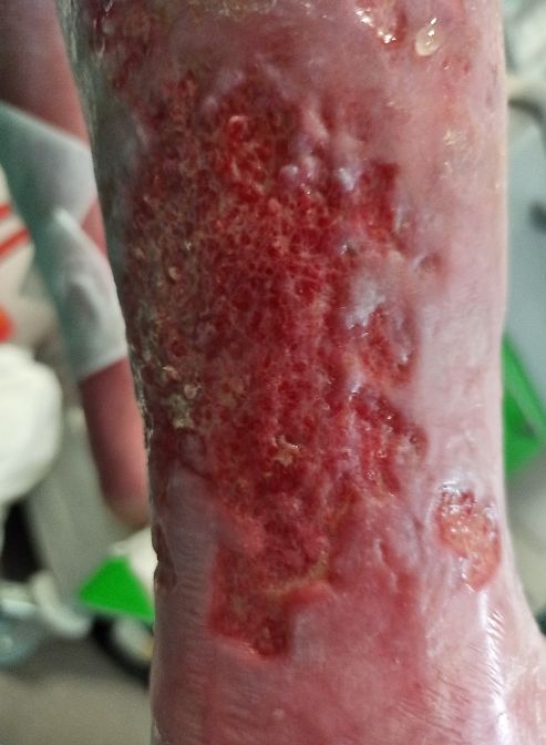 obr 2c 1. den obr 2c 1. den