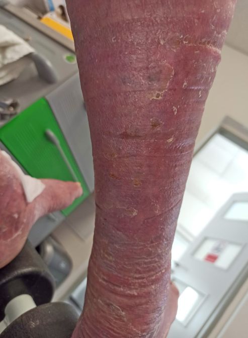 obr 2e 82. den obr 2e 82. den