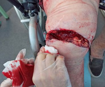 obr 3a v&nbsp;den úrazu