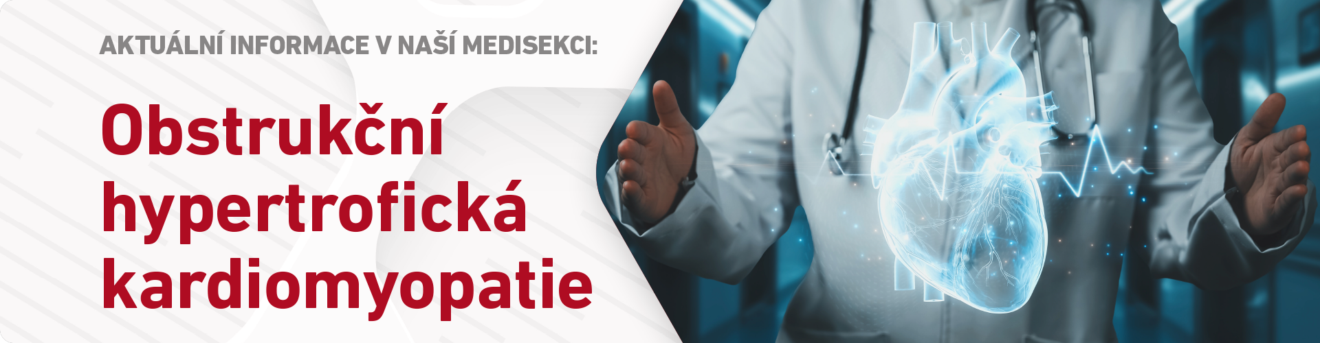 Obstrukční hypertrofická kardiomyopatie