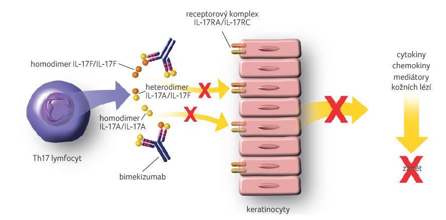 OBR. 1 Mechanismus účinku bimekizumabu. Převzato a upraveno: Bimekizumab. Guide des anticorps monoclonaux à usage thérapeutique (https://acthera‑univ‑lille.fr); [3] – Adams, et al., 2020. IL – interleukin
