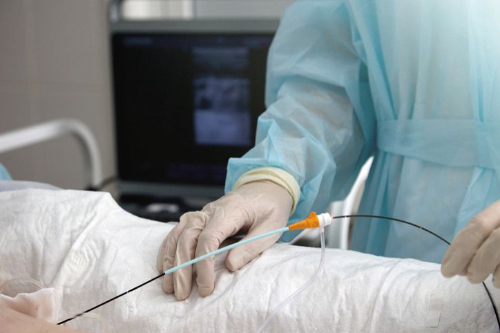 In hand surgeon in medical gown and gloves catheter for treatment varicose veins