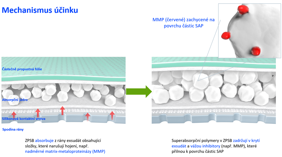 Obrázek 1: Složení krytí Zetuvit Plus Silicone Border (a), mechanismus účinku (b). MMP = matrix-metaloproteinázy; SAP = superabsorpční polymer. 