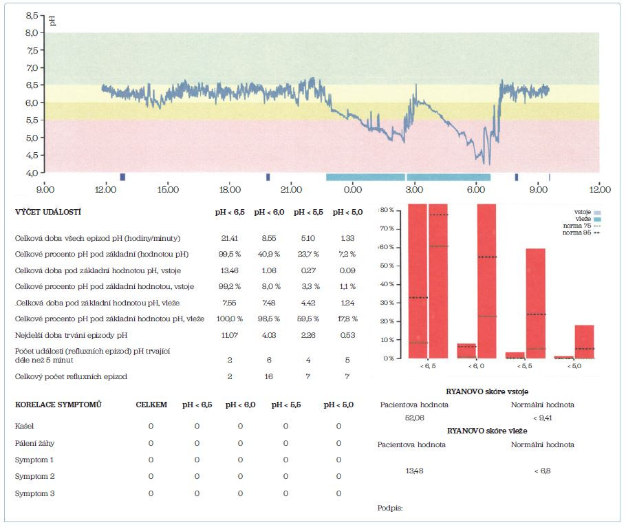 Obr. 4 Patologický záznam 24hodinové monitorace orofaryngeálního pH: Během 24hodinové monitorace jsme zaznamenali ve vzpřímené poloze po celou dobu měření slabě kyselé pH. V nočních hodinách v poloze vleže jsme zaznamenali výrazně kyselé refluxní epizody. Ryanovo skóre pro vzpřímenou polohu je 52,06 (norma < 9,4). Ryanovo skóre pro polohu vleže je 13,48 (norma < 6,8). Vyšetření prokazuje refluxní etiologii potíží pacienta (EERCH). EERCH – mimojícnová refluxní choroba jícnu (extraezofageální refluxní choroba)