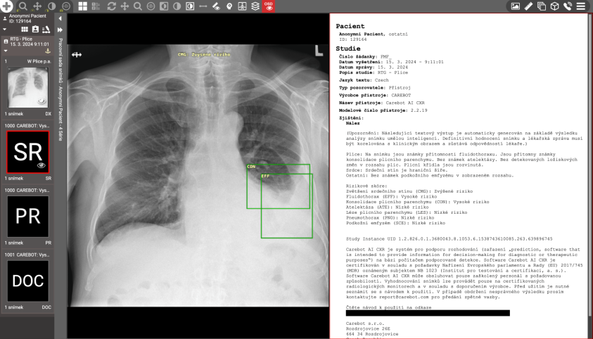 Carebot AI CXR, foto: Carebot