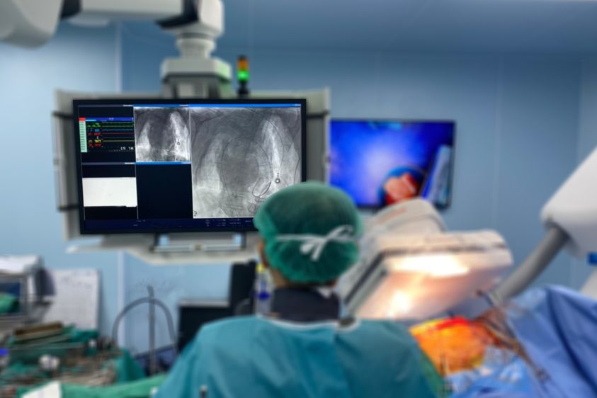 iStock-1328681702_intervenční kardiologie