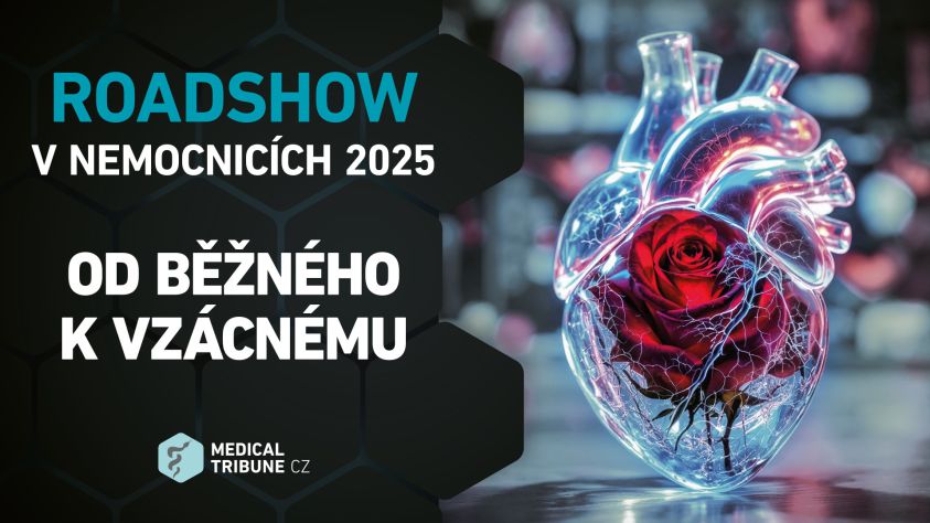 07-SELF MT roadshow 2025-02 VFN Praha prezentace-1