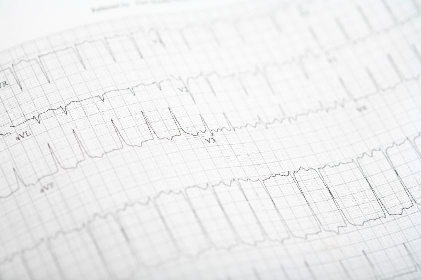 A8 iStock-1411866111