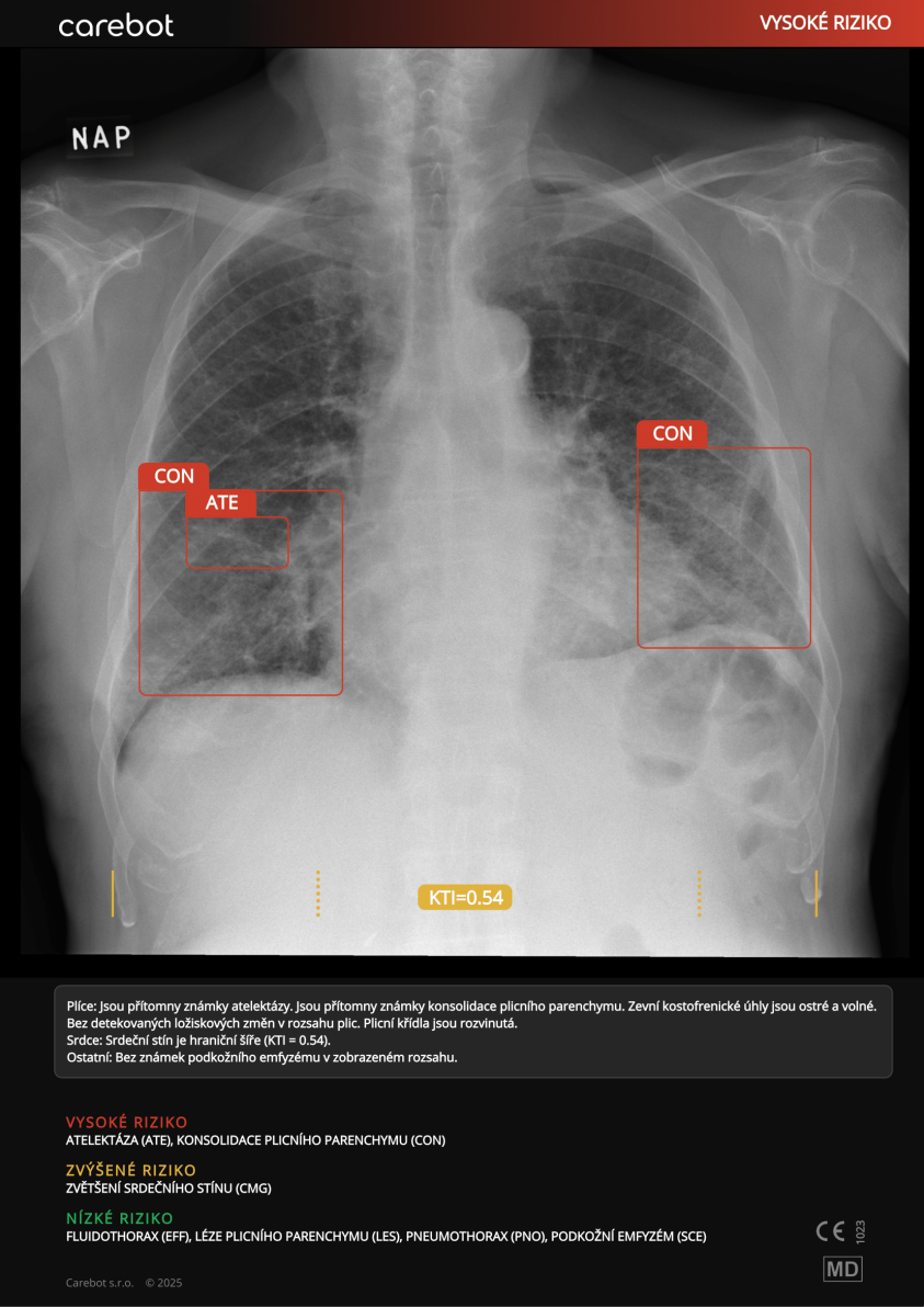 AI CXR_2