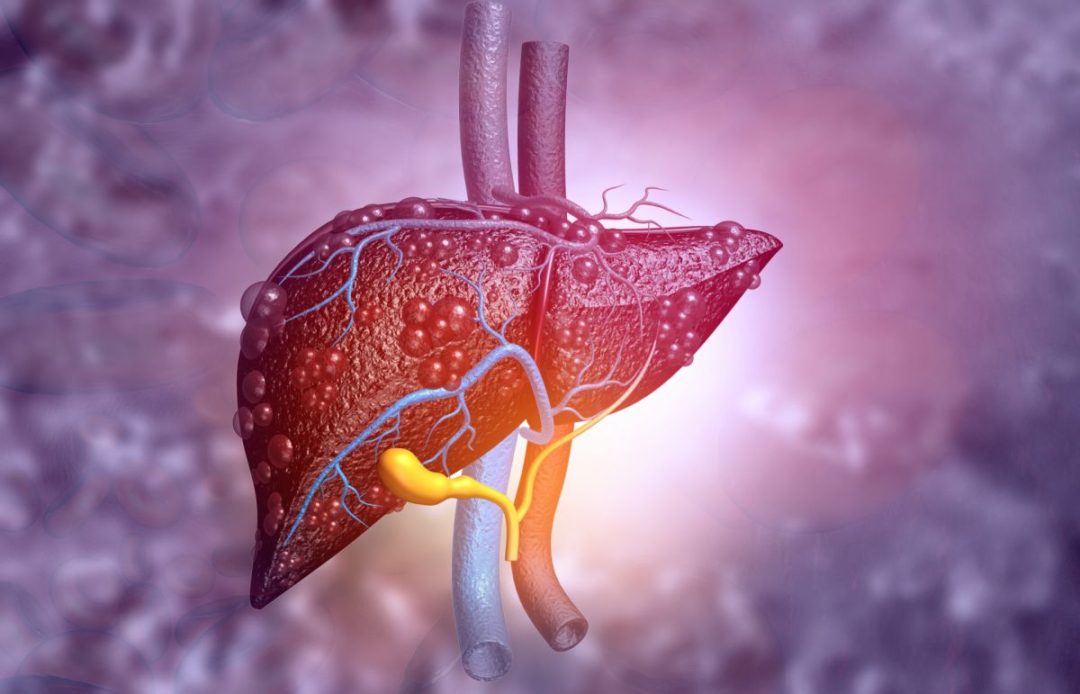 Foto: shutterstock.com