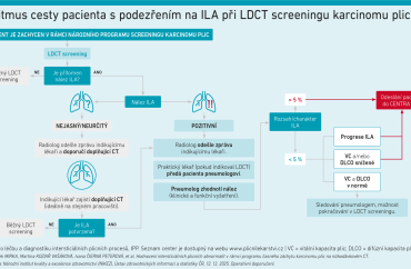 schéma Algoritmus cesty pacienta