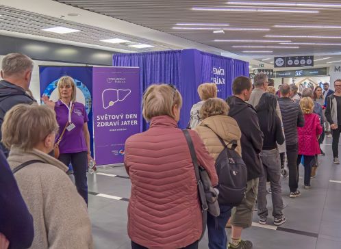 Zájemci čekající na&nbsp;elastografické vyšetření a&nbsp;konzultaci s&nbsp;hepatologem